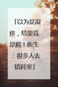 以为是湿疹，结果竟是癌！医生：很多人去错科室